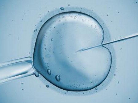 体外受精 IVF-ET